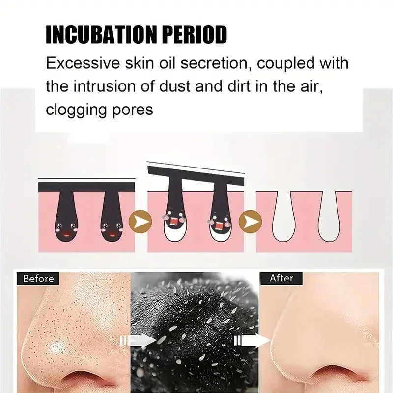 50/100PCS Bamboo Charcoal Nasal Strips Blackhead Remover Mask Acne Pimples Treatment Patch Shrink Pores Nose Stickers Skin Care